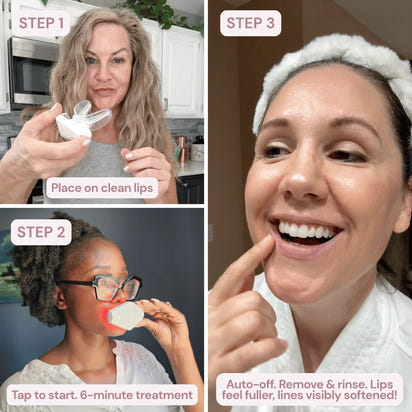 Vynelia | Erase Lip Lines Without Injections in Just 6 Minutes a Day – Made for Mature Lips