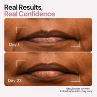 Vynelia | Erase Lip Lines Without Injections in Just 6 Minutes a Day – Made for Mature Lips