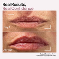 Vynelia | Erase Lip Lines Without Injections in Just 6 Minutes a Day – Made for Mature Lips