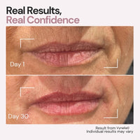 Vynelia | Erase Lip Lines Without Injections in Just 6 Minutes a Day – Made for Mature Lips