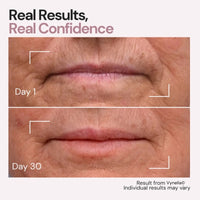 Vynelia | Erase Lip Lines Without Injections in Just 6 Minutes a Day – Made for Mature Lips